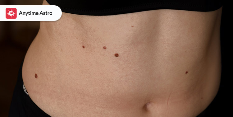 importance of mole on stomach